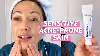 A Nighttime Skincare Routine for Sensitive AcneProne Skin  Skincare with SusanYara [upl. by Anivlis511]