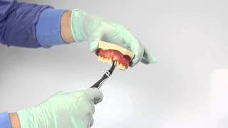 Tutorial 1  extracting forceps [upl. by Enyledam]