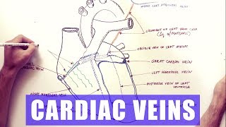 Describing coronary artery anomalies [upl. by Anuahsed]