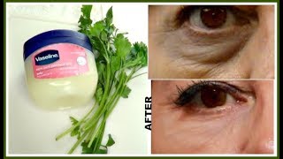 7 DAYS TO REMOVE DARK CIRCLES EYE BAGS  EYE WRINKLES AND LINES Khichi Beauty [upl. by Clarita871]