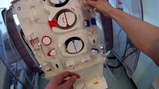 How a Dialysis Machine Works  Dialysis  ARTIFICIAL KIDNEYS [upl. by Bamby]