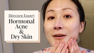 A Dermatologist’s Nighttime Skincare Routine for Hormonal Acne amp Dry Skin  Skincare Expert [upl. by Lee60]