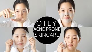 Basic Oily amp AcneProne Skincare Routine and Essentials [upl. by Noseyt]