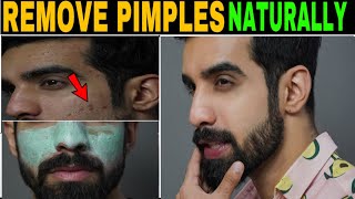 How to Remove PIMPLE NATURALLY FAST REALITY  Acne treatment TheFormalEdit  Hindi [upl. by Brucie]