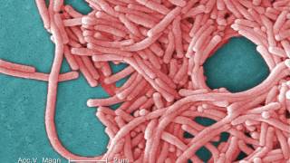 Legionnaires Disease What You Need to Know [upl. by Aihseken652]