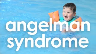 Angelman Syndrome in one word  Angelman UK [upl. by Virgina]