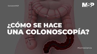 ¿Cómo se hace una colonoscopía ExclusivoMSP [upl. by Blainey717]