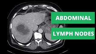 Having a lymph node biopsy [upl. by Analaf]