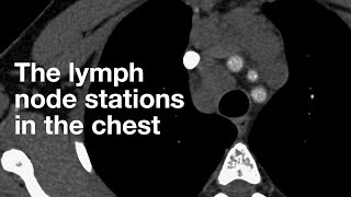 Lymph nodes how to build an immune response [upl. by Eintruoc575]