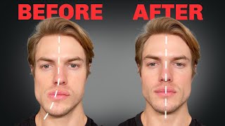 How to Fix Asymmetrical Jaw amp Face FOREVER [upl. by Wang]