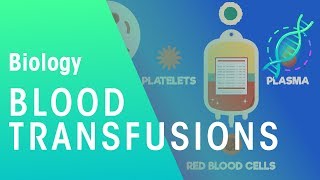 Blood transfusion Setup and transfusion [upl. by Sarita597]