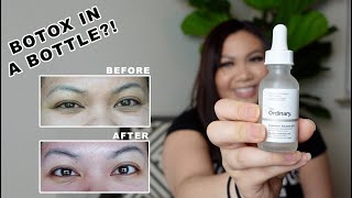 The Ordinary Argireline Solution 30 Day Trial  Before amp After  Reduce Fine Lines and Wrinkles [upl. by Kort207]