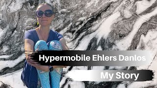 Hypermobile Ehlers Danlos SyndromeMy Story [upl. by Bronez]