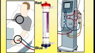 Setting Up of Dialysis Machine [upl. by Anined]