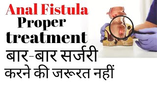 Fistula ka best treatment kya hai [upl. by Mohsen924]