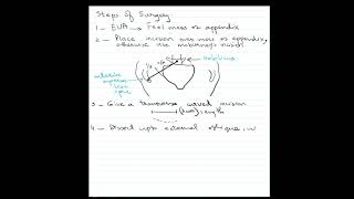 Precautions to take after appendix removal  Dr Sharat Honnatti [upl. by Ailime]