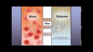 Hemodialysis Hemofilter and countercurrent animation [upl. by Emmery]