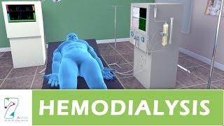 Hemodialysis [upl. by Analihp]