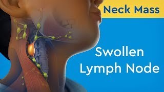 Axillary Lymph Nodes Dr Adel Bondok [upl. by Serolod577]