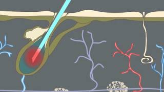 How Electrolysis Works Animation [upl. by Denni]