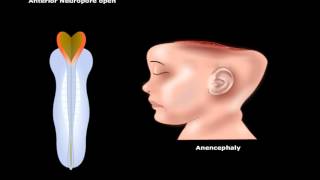 USMLE® Step 1 Neuroscience Development of CNS Animation [upl. by Lenoj59]