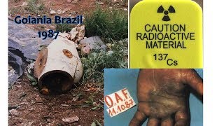 the Goiania Cesium 137 radiological accident [upl. by Clemence]