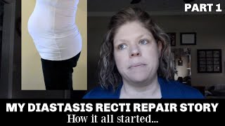 My Diastasis Recti Repair Story  From Exercises to Surgery [upl. by Brouwer]