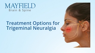 Facial Pain Treatment Treatment Options for Trigeminal Neuralgia [upl. by Feingold861]