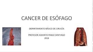 Cáncer de Esófago Presentación Clínica Paraclínica y Diagnóstico [upl. by Charyl]