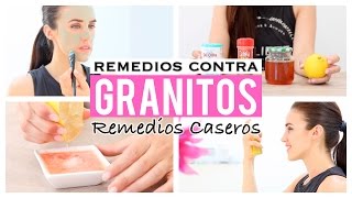 5 remedios caseros para eliminar los granitos [upl. by Awjan]