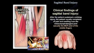 Ankle Ligaments Anatomy  Everything You Need To Know  Dr Nabil Ebraheim [upl. by Tnert569]