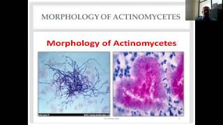 Actinomycetes and Nocardia Diverse Group of Gram Positive Bacilli [upl. by Ilohcin]